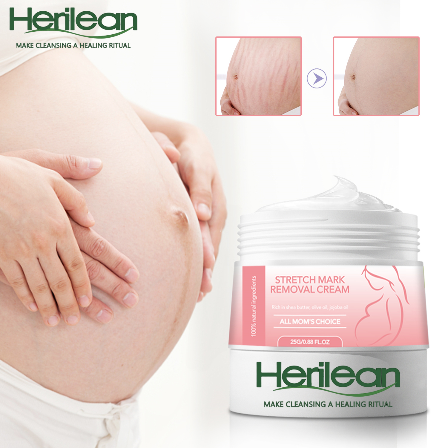 HERILEAN-Stretch Mark Removal Cream