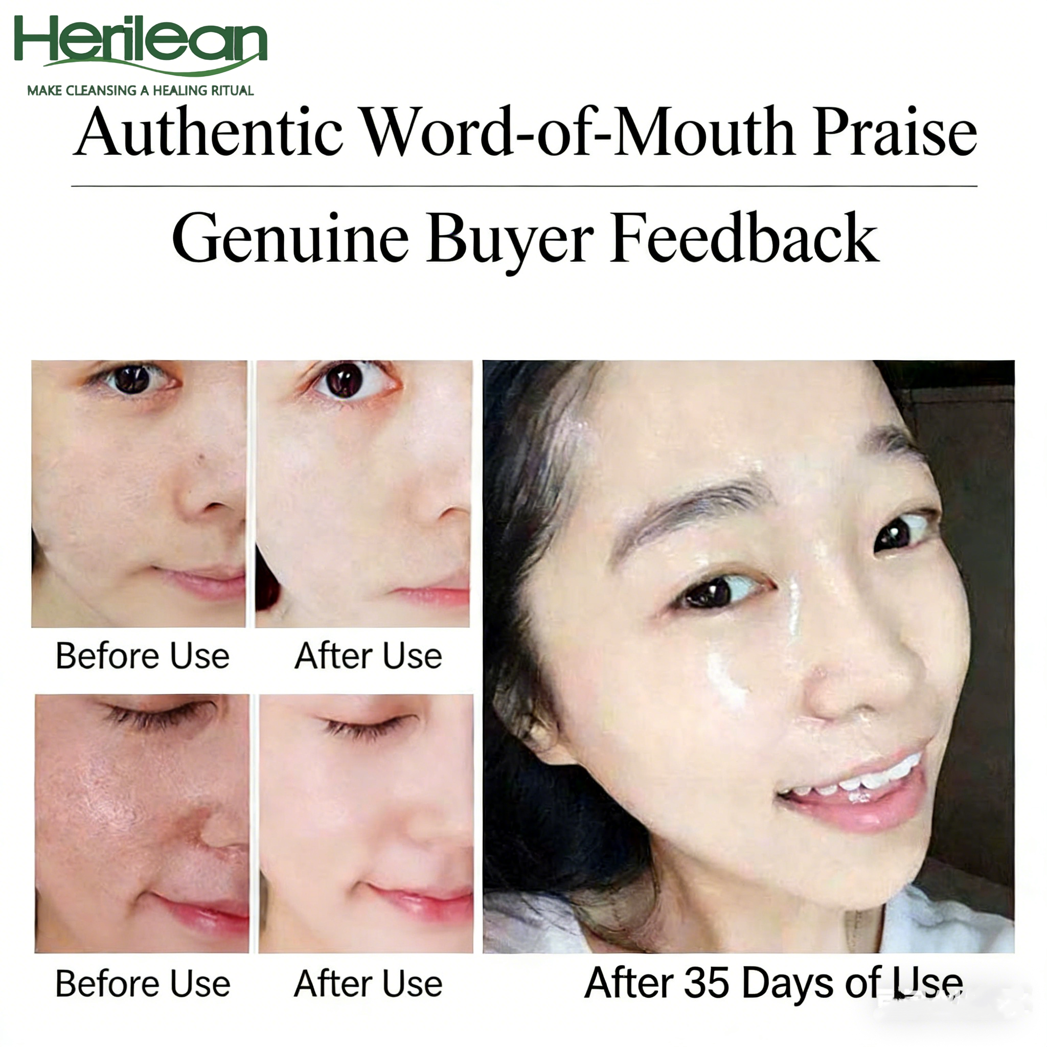 HERILEAN-5% Niacinamide Facial Serum
